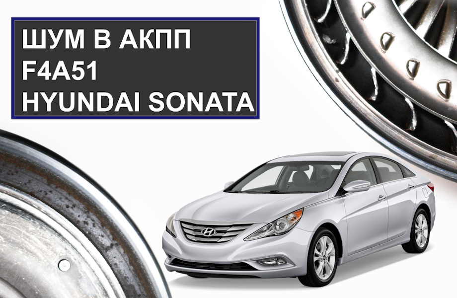 Шум и рывки АКПП Hyundai Sonata